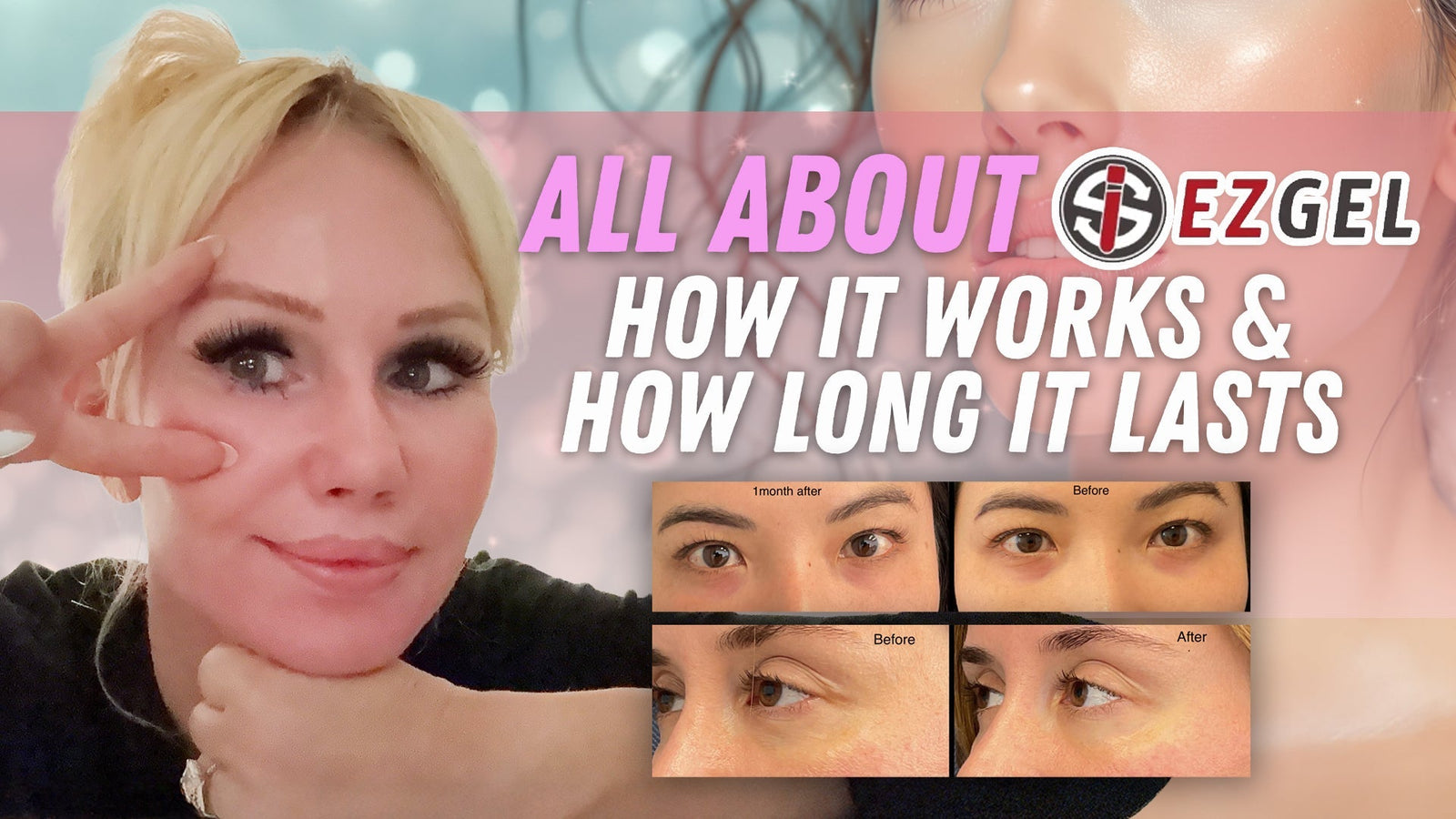 EZ Gel: The Anti Aging Alternative to Traditional Fillers