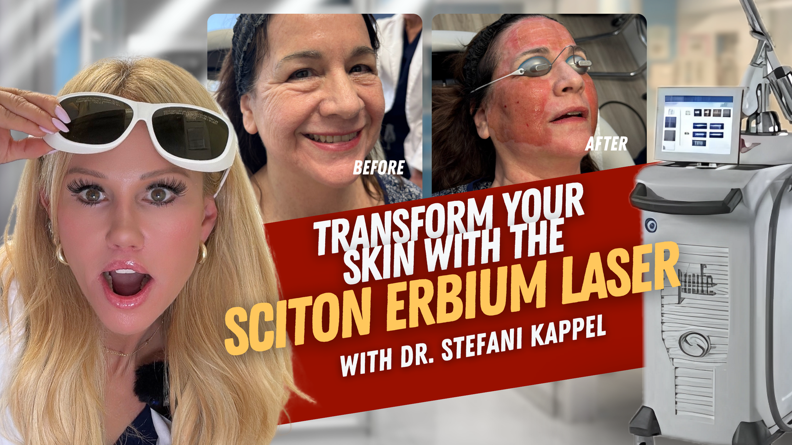 THIS Laser ERASES 20 Years of Damage - The Sciton Erbium Laser Changes Everything